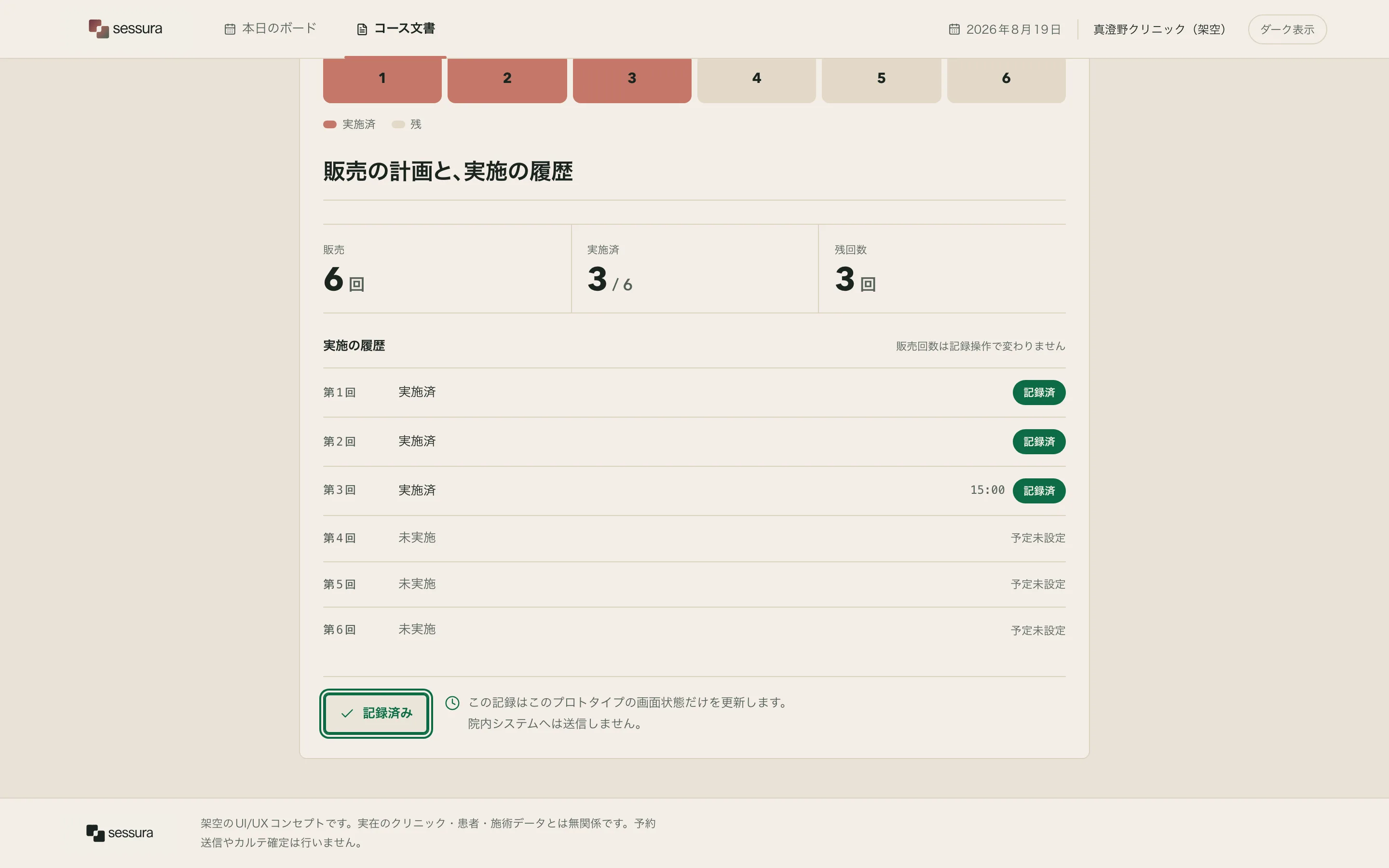 The Sessura course document immediately after recording. A green success banner states 本日の回を記録しました with the new figures 実施済 3 / 6 ・ 残回数 3 beneath it. The six-pill meter now shows three clay-filled pills. The figure row reads 販売 6 回, 実施済 3 / 6, 残回数 3, and the delivery history has gained a line for today's session carrying a 記録済 chip. The primary action is now disabled.